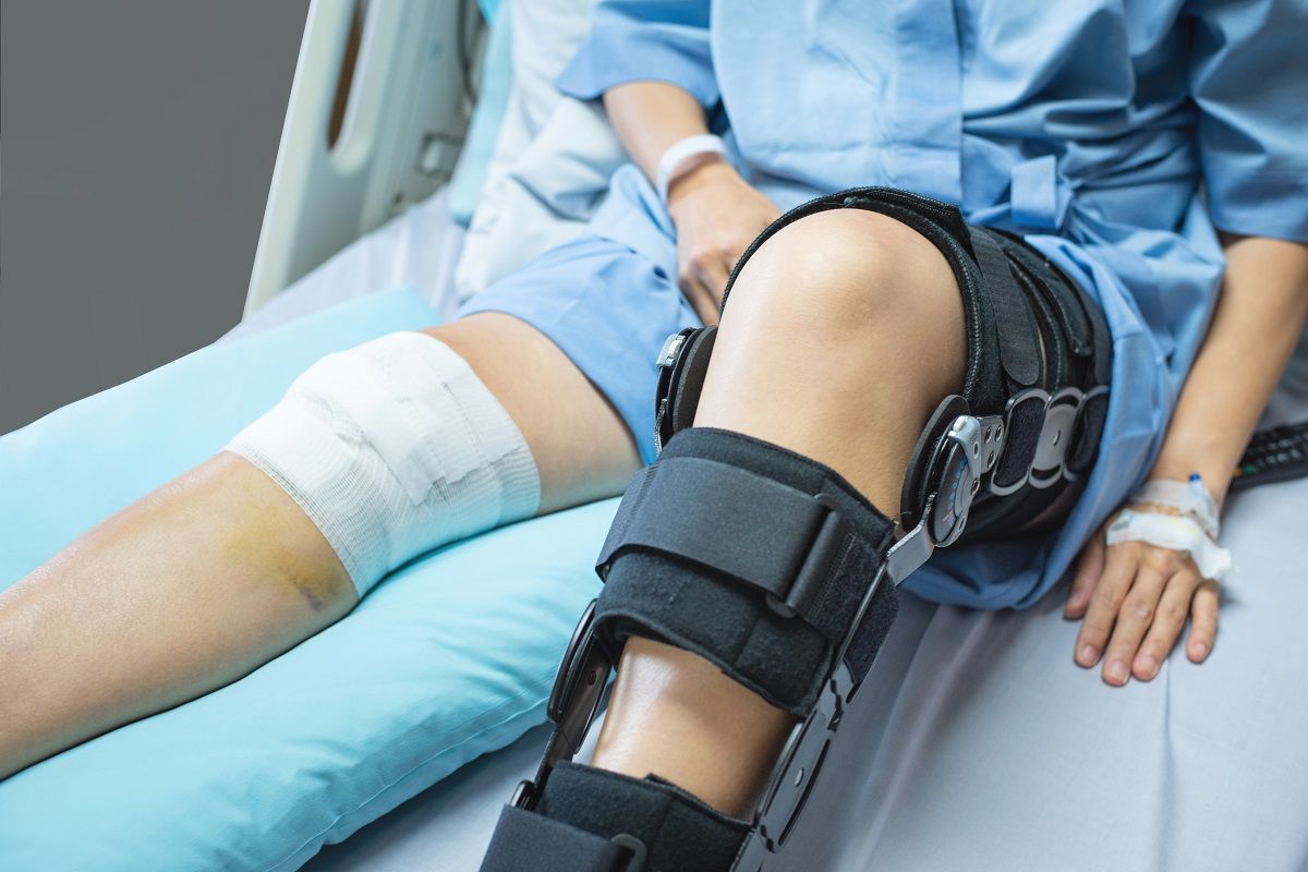 How to Properly Recover from an Orthopedic Surgery