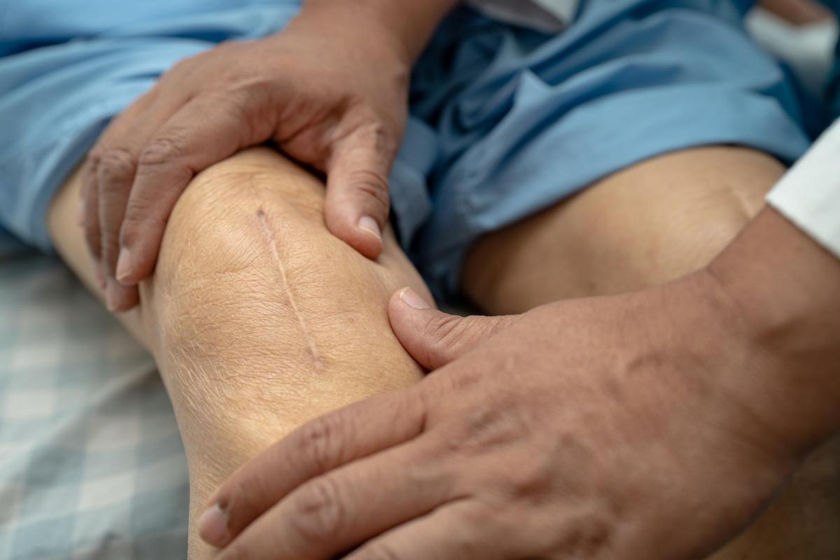 Healing from Knee Replacement
