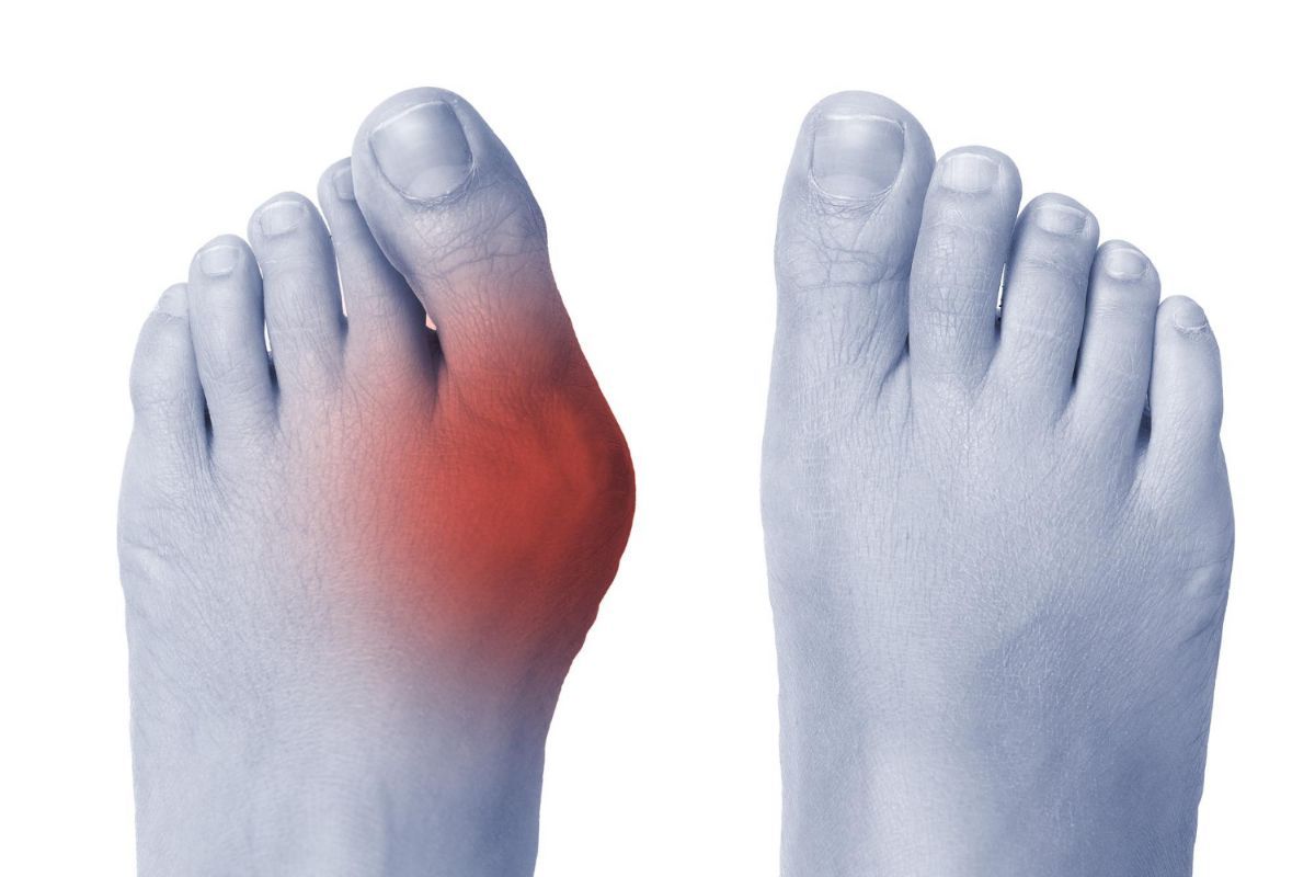 4 Common Foot Problems
