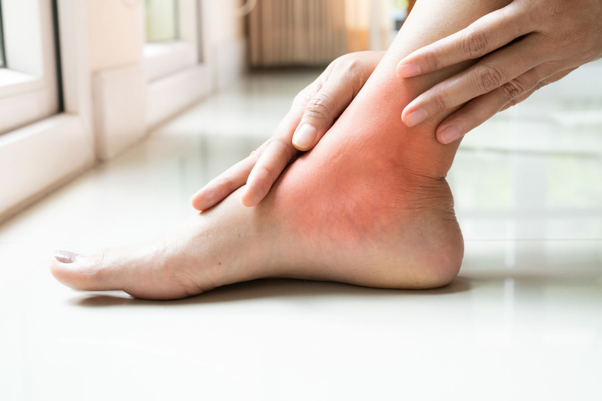 Signs You May Have a Sprained Ankle