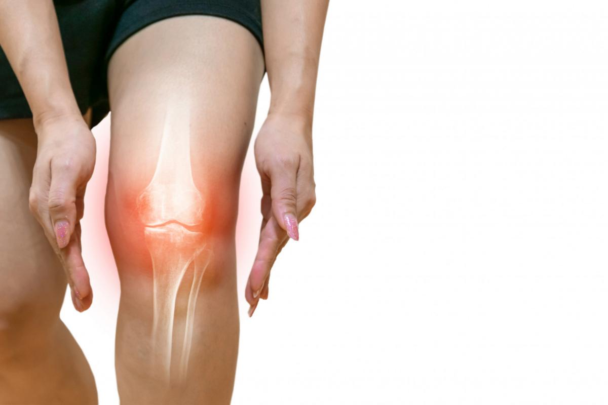 Signs It Is Time for a Knee Replacement