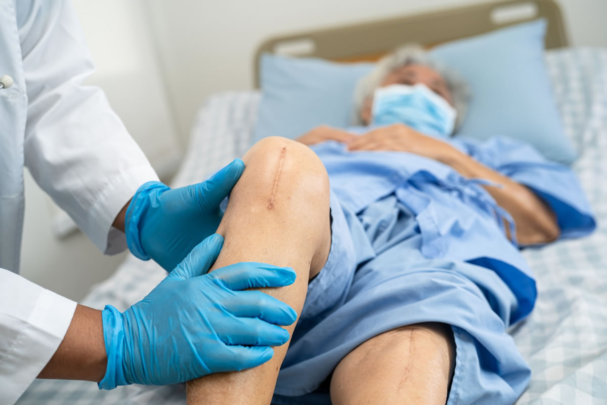 Four Stages of Knee Replacement Surgery Recovery