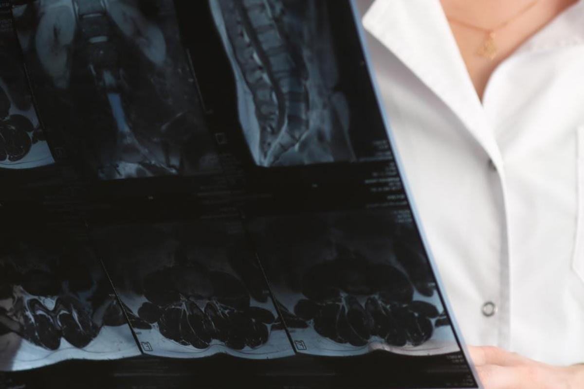 Lumbar Spinal Fusion: What to Expect During Recovery