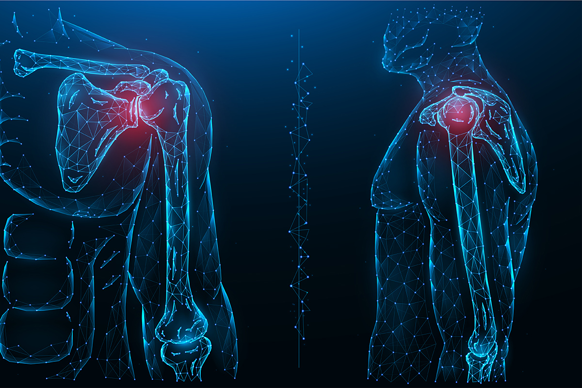 Shoulder Surgery Options for Orthopedic Patients