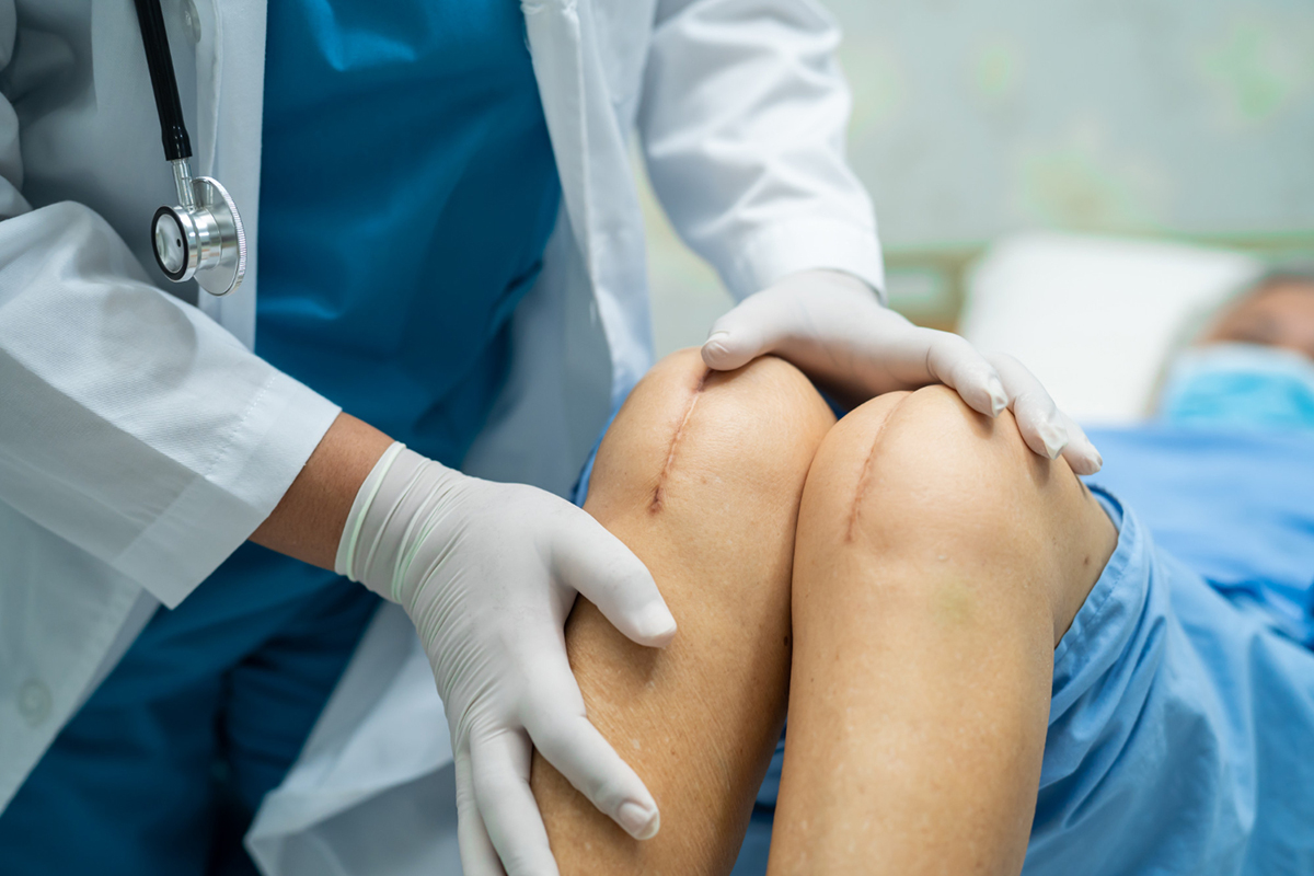 What to Expect After Knee Replacement Surgery