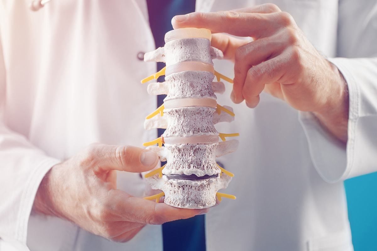 Understanding The Other Common Terms for Spinal Fusion Surgery