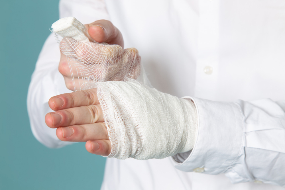 Bruised Hand: What You Need to Know About Managing It
