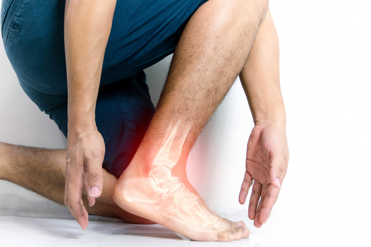 Understanding Chronic Ankle Instability