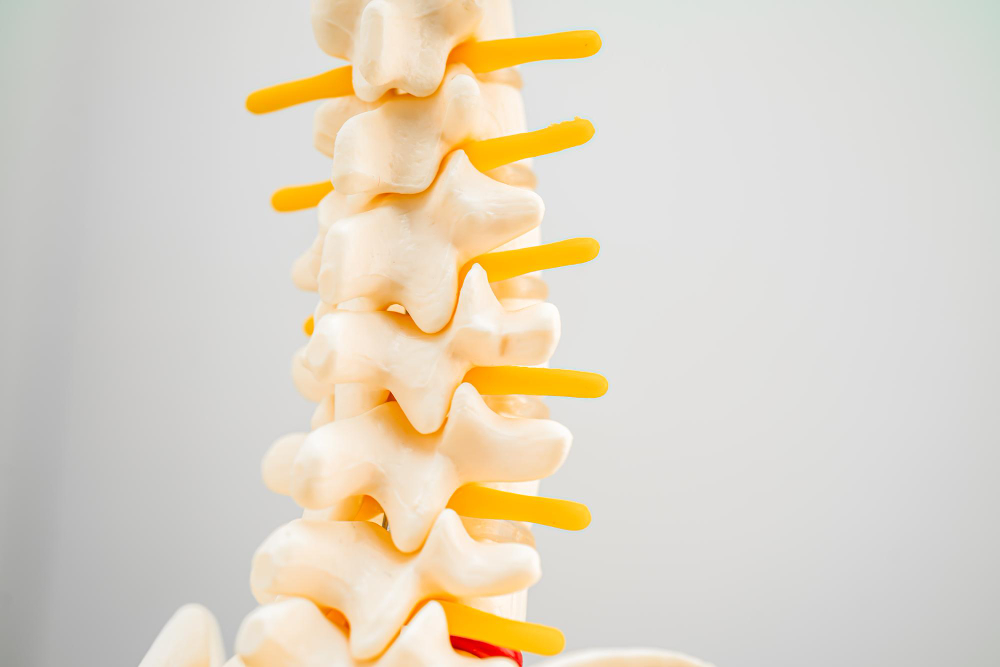 Getting Ready for Your Discectomy: A Comprehensive Guide