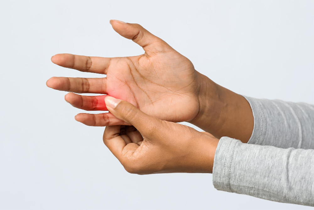 What Is Trigger Finger and Why Does It Happen?
