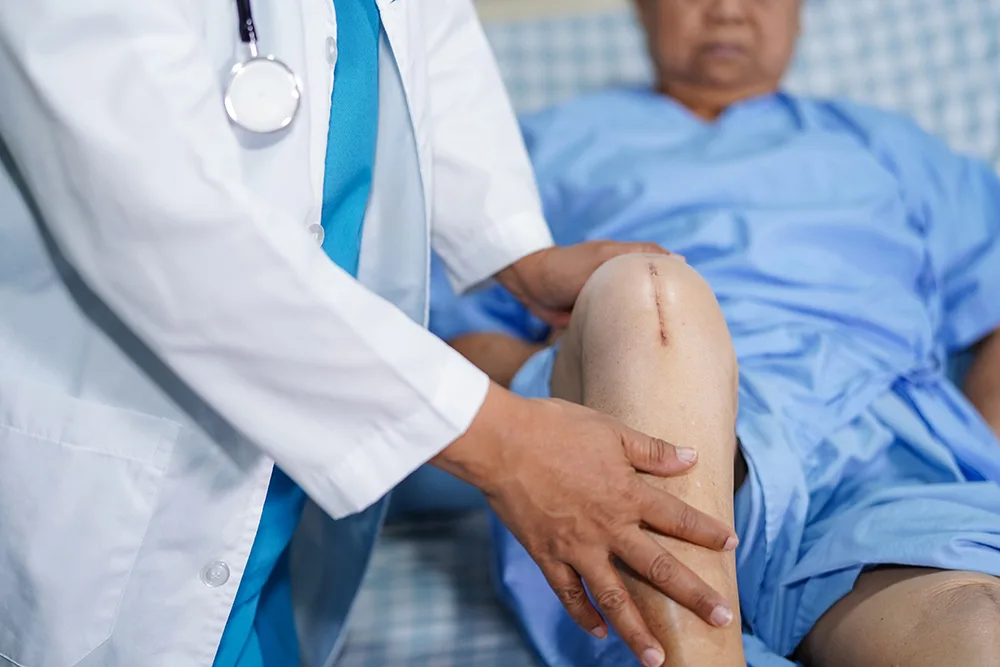 What to Expect with Knee Arthroscopy: A Complete Guide