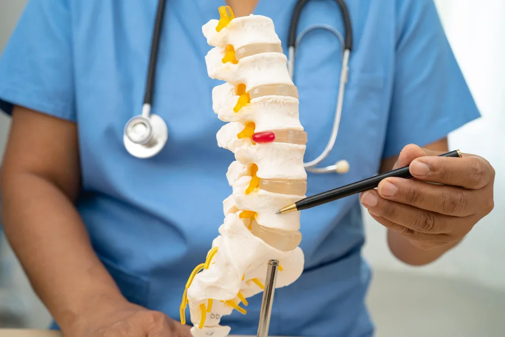 What Is a Discectomy and When Is It Needed?